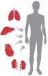 organ transplant